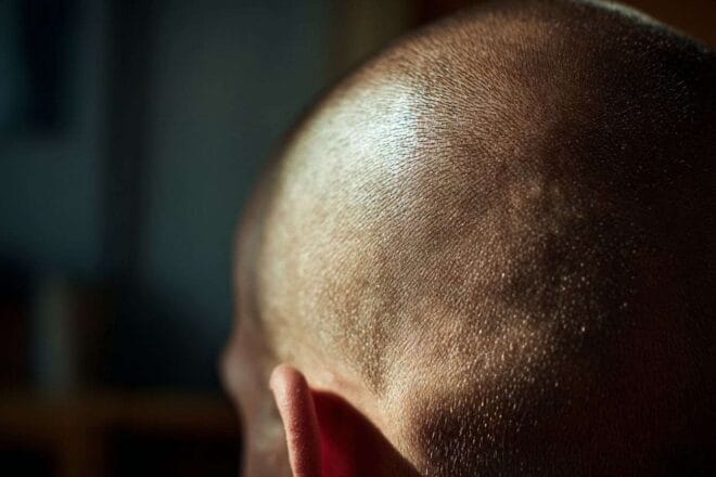 Gros plan d un cuir chevelu lisse